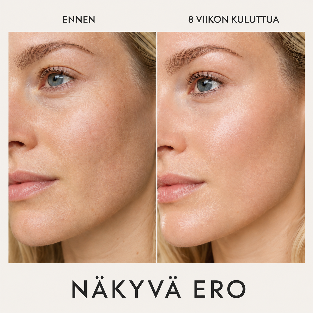 Ennen ja jälkeen kuva ihosta kahdeksan viikon Essence Lift Pro -käytön jälkeen