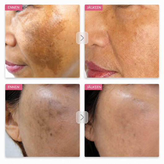 Arbutin 7% Brightening Cream