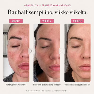 Arbutin 7% Brightening Cream