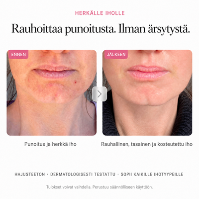 Arbutin 7% Brightening Cream