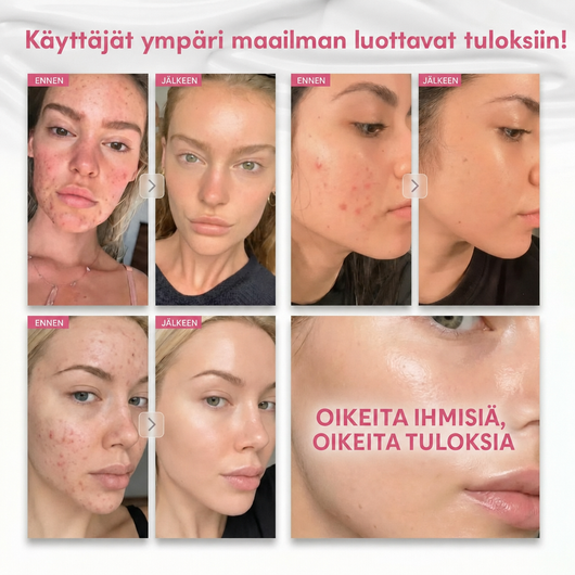Käyttäjien ennen ja jälkeen kuvia Arbutin 7% Brightening Cream -voiteesta