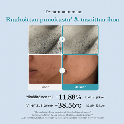 Ennen ja jälkeen kuvat ihon punoituksesta ja huokosista